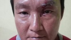 Siram Wajah Ketua Komisi II DPRD Kampar Dengan Air Cabai, Pelaku Diamankan Polsek Siak Hulu